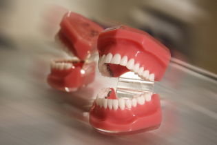 Fogsorminta fogszabályozáshoz
